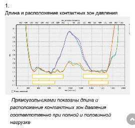 распределение пятен контакта (из статьи Александра Рязанова)